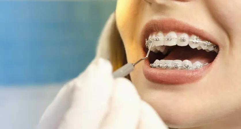 children’s braces