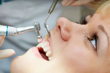 Teeth cleaning and polishing