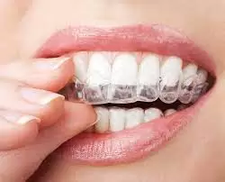 invisalign braces cost